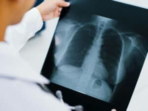 Scopri di più sull'articolo Dove buttare lastre radiografiche