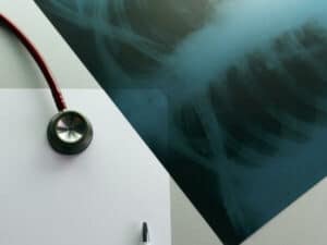 stetoscopio e lastra radiografica su un tavolo